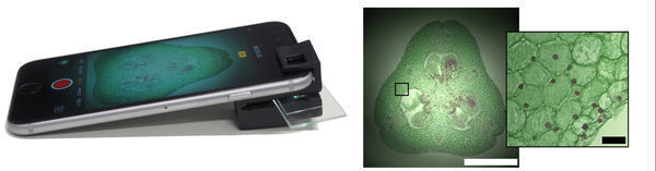 Add-on clip turns smartphone into fully operational microscope