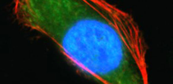 Terahertz wave activates filamentation of actin