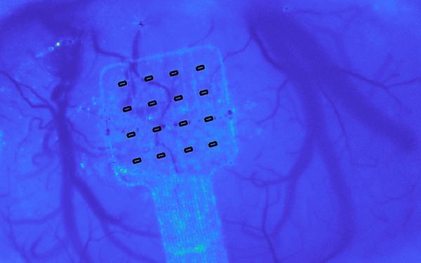 Graphene sensors can hear your brain whisper