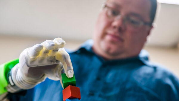 Minimuscles let amputees control a robot hand with their minds