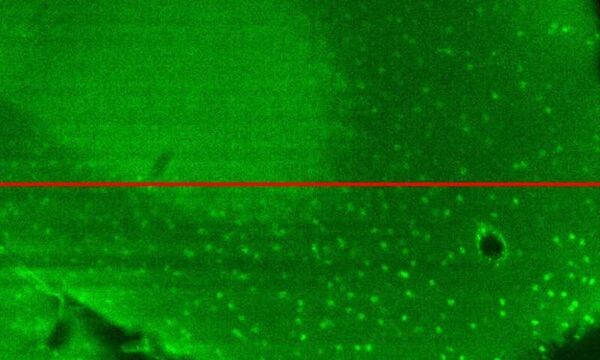 Plug-and-Play Lens Simplifies Adaptive Optics for Microscopy