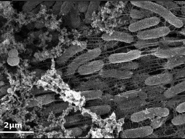 Metal-Breathing Bacteria Could Transform Electronics, Biosensors, and More