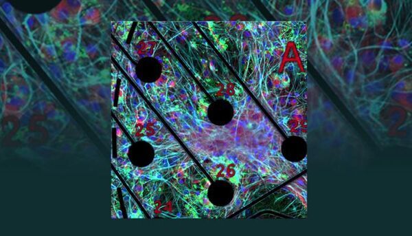 Neuronal cultures advance ‘brain-on-a-chip’ technology