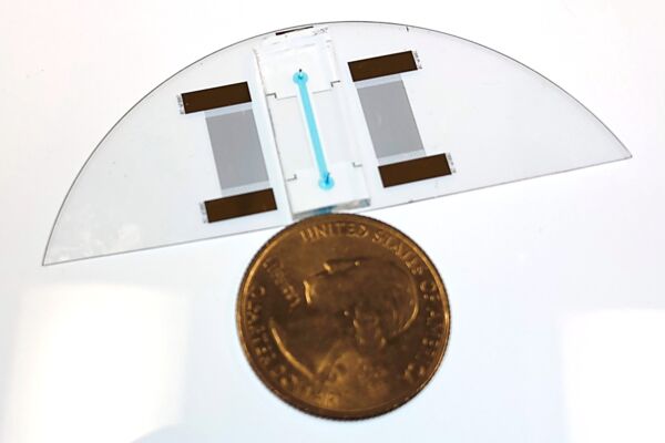 New technology diagnoses sickle cell disease in record time