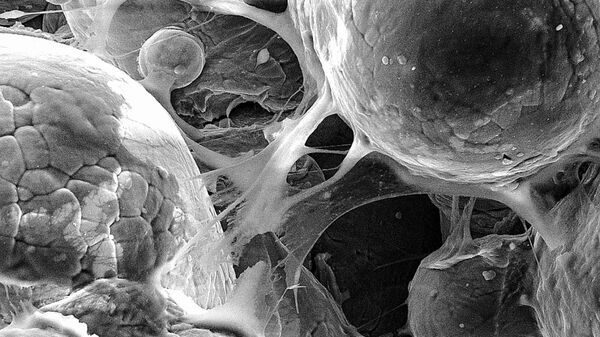 Researchers 3D-print biomedical parts with supersonic speed