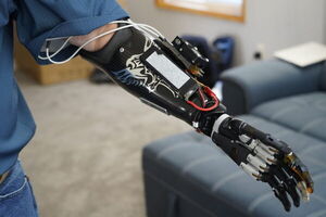 First-Hand Experience: Deep Learning Lets Amputee Control Prosthetic Hand, Video Games