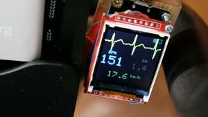 Orbitrack ESP32 computer with ECG