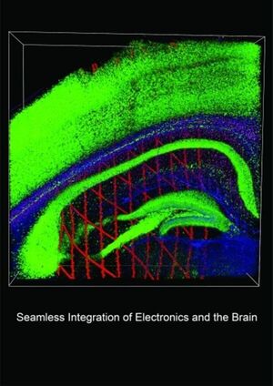 For the first time, it’s possible to record long-term electrical activity in a single brain cell