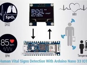 IoT-Based Remote Patient Monitoring System to Measure Vital